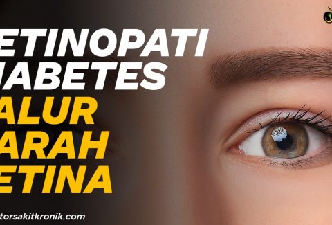 retinopati-diabetes-min